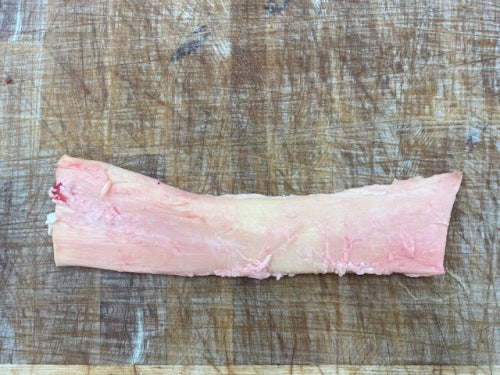 Nuchal Ligament